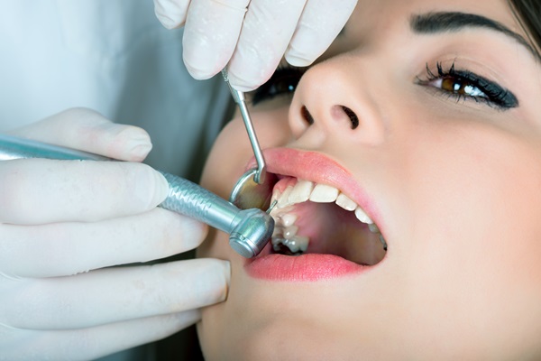 How Tooth Colored Fillings Contribute To Cosmetic Dentistry